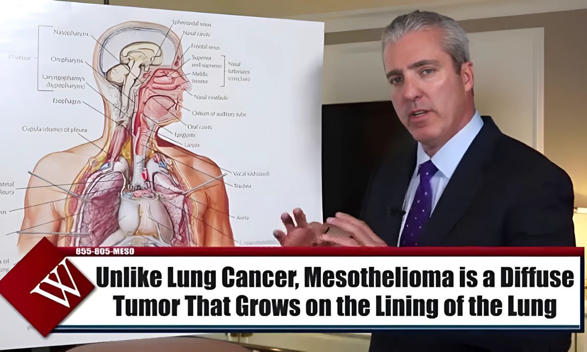 Lowell Mesothelioma Legal Question Everything You Need To Know